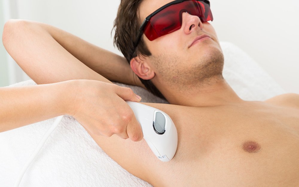 Laser-Haarentfernung für Männer bei Rosalia Laser & Beauty München