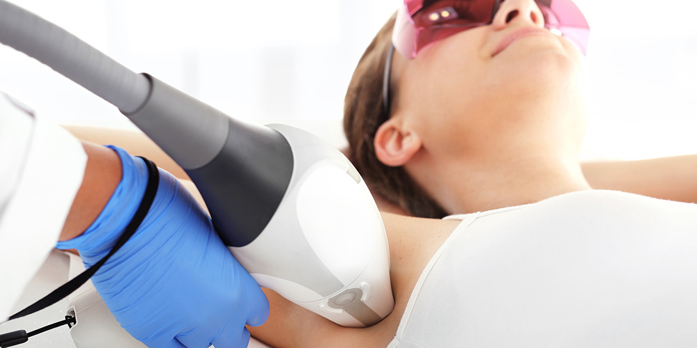 Dauerhafte Haarentfernung der Achseln bei Rosalia Laser & Beauty München